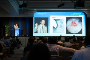 Shoulder Arthroplasty Presentation